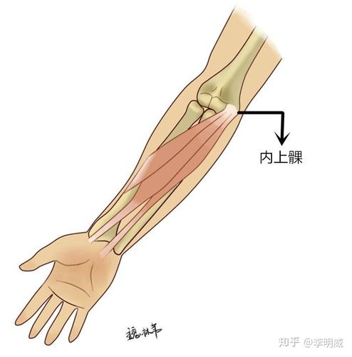 高尔夫球肘的诊断